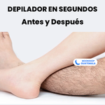 OFERTA⭐️ Spray Depilador para Hombres y Mujeres - 100% ORIGINAL Y SIN DOLOR